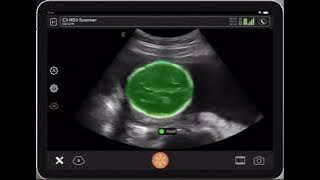 a79ba2c931c0b50e8b32088c8e5a4396