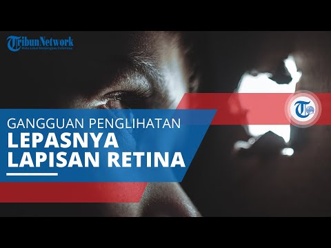 Video: Haruskah Anda terbang dengan retina yang terlepas?