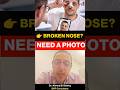 Why Doctors Ask for Old Photos After a Nose Injury