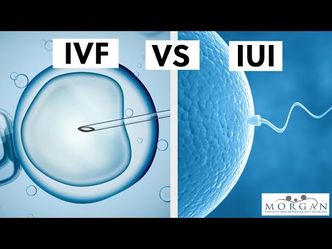 Videó: Különbség Az IVF és Az IUI Között