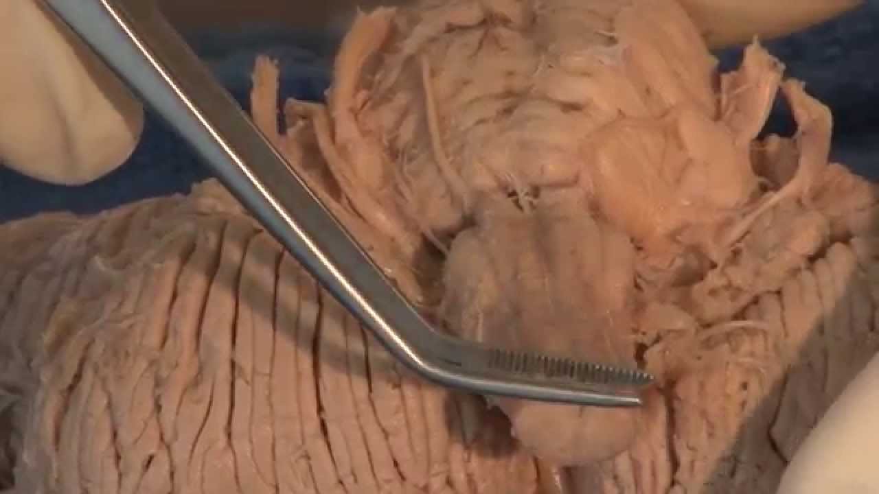 Cranial Nerves: Neuroanatomy Video Lab - Brain Dissections - YouTube