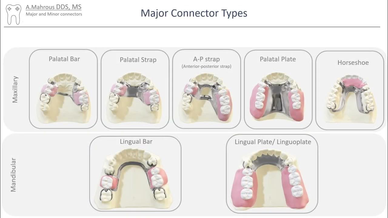 rpd-major-minor-connectors-in-5-mins-youtube