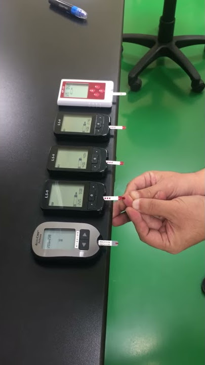 AP-10 Blood Glucose Monitoring System (LeisonBio) vs Roche