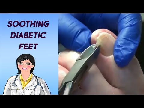Diabetic Nail Trim - And Music