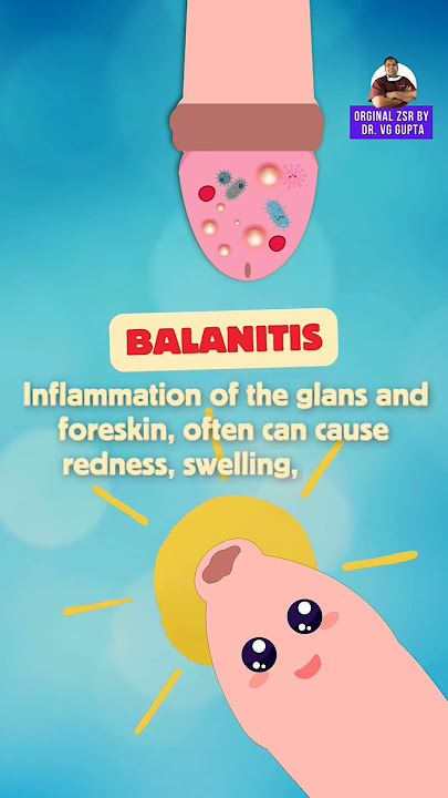 What is Phimosis (Animation)