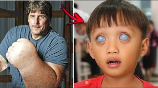 10 Amazing & Unique People Who Shock The World