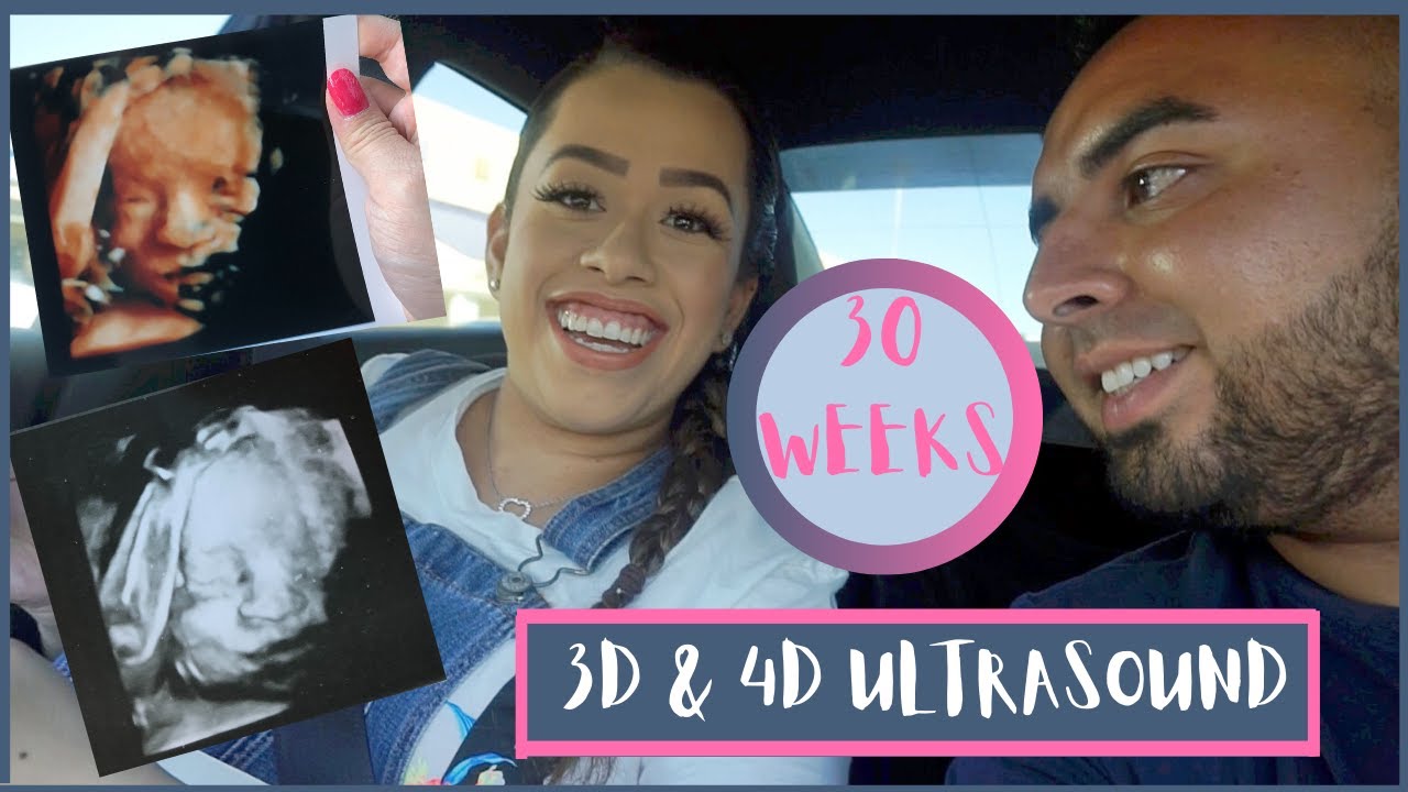 HD LIVE ULTRASOUND 4D & 3D | 30 WEEKS PREGNANT | (EXCITING) | 3RD ...