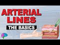 Arterial Line Basics Quiz