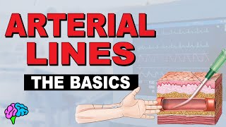 What is an Aline? Arterial Line Basics EXPLAINED!