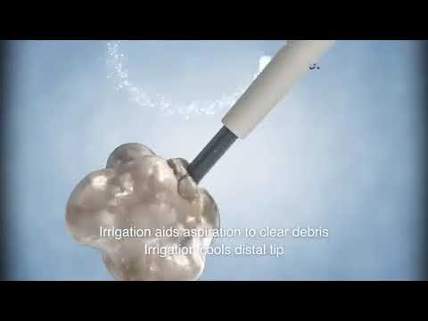 Necod -SONOPET ASPIRADOR ULTRASÓNICO STRYKER - - YouTube