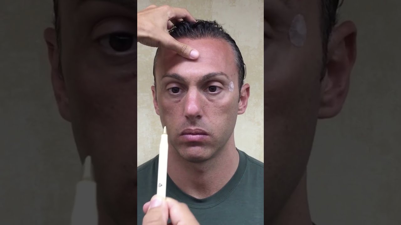 How To Fix Your Lazy Eye In 30 Seconds Shorts