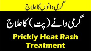 Prickly heat ka ilaj | Garmi Dano Ka ilaj | Heat rash treatment | Pit ka ialj | Dr Jahangir Yasir