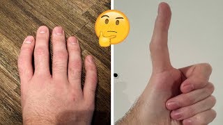 People Are Sharing Photos Of Their Unusual Body Parts, And The Internet Is Amazed New Pics