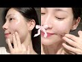 OVERFORCED FORMULA 💉🔬౨ৎ 1X clear baby skin + complete removal of all impurities