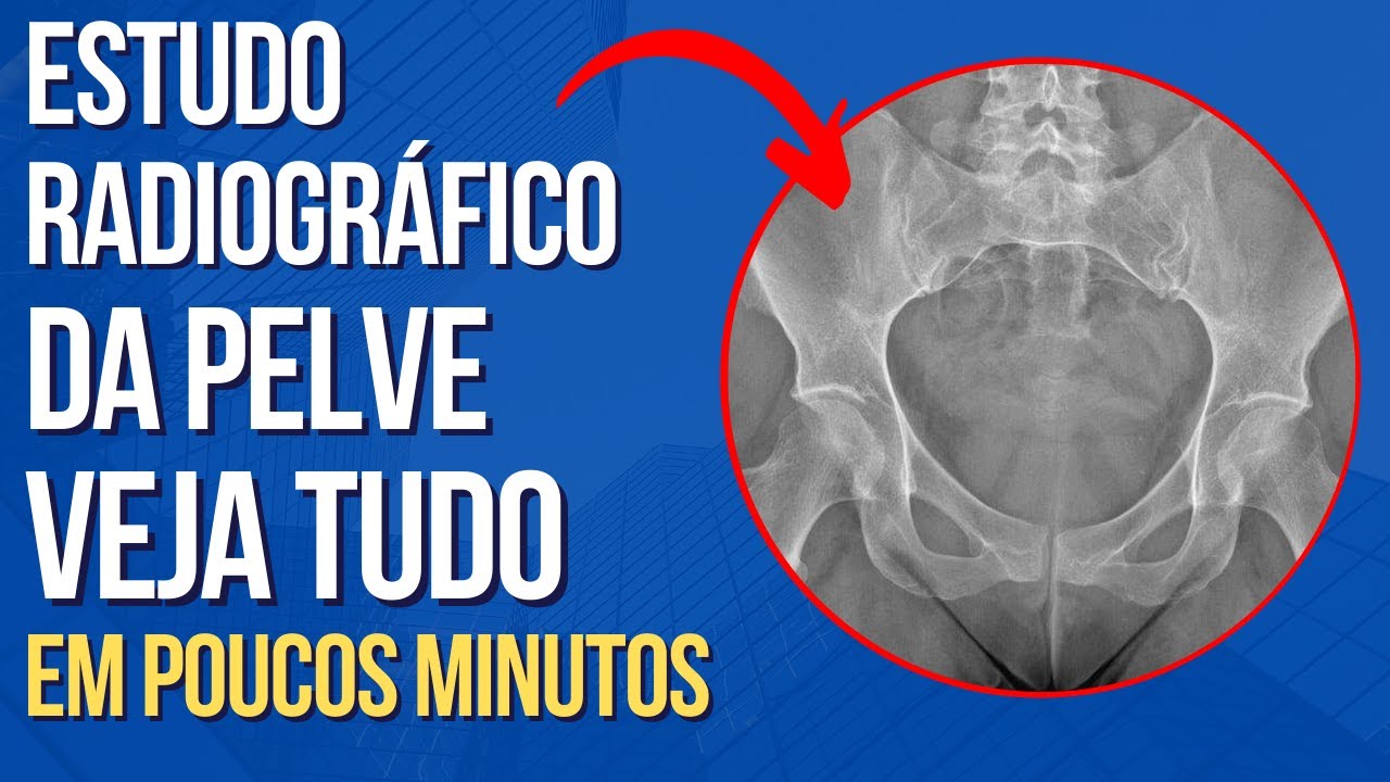 Anatomia radiográfica da pelve