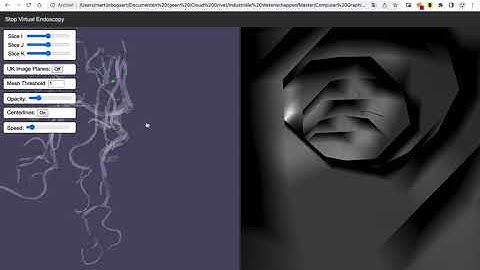 Cardiovascular visualization - VTK.JS