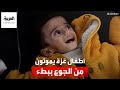 أطفال غزة يموتون ببطء بسبب سوء التغذية والمناشدات تتعالى لوقف الحرب وإنهاء المعناة أطفال غزة يموتون ببطء بسبب سوء التغذية والمناشدات تتعالى لوقف الحرب وإنهاء المعناة