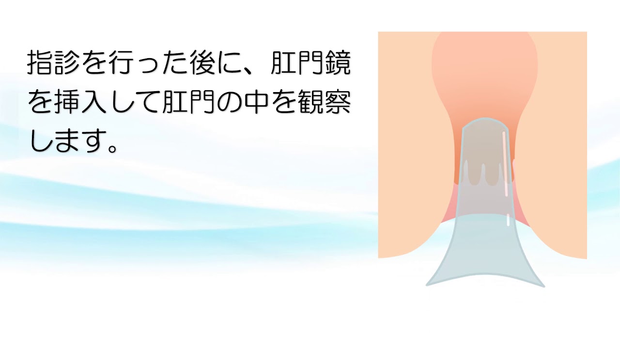 肛門科の診察～肛門鏡で何が見える？～【ららぽーと横浜クリニック】