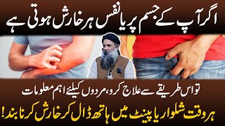 itching in Private Area Men | Sharamgah Mein Kharish Ka ilaj Dr Sharafat Ali Short Fitness Tips New