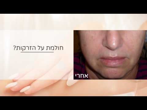 אקנה בפנים , הזרקות, כתמים בפנים - YouTube