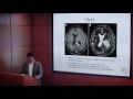 VIDT | Curso de Neuro-oncología Gliomas de alto grado - Dr. José Máximo Barros