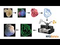 3D bioprinting of organs