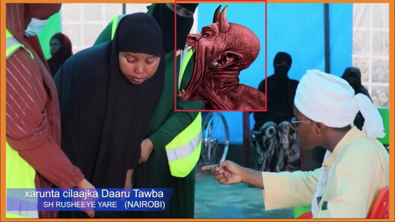 Subxanallah 18 Sano Ayay Sixranayd, Indhaha Weershe Ayaa Laga Dhigay, Dhagna Way Beeshay Way fcntahy