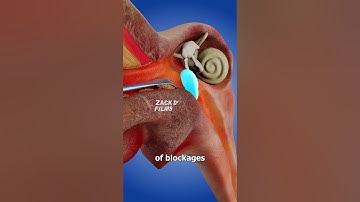 How Ear Spoons Work 🤔