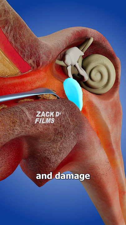 How Ear Spoons Work 🤔