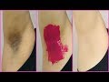 How To Lighten Dark Underarms PERMANENTLY - 100% Naturally | Anaysa