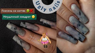 :         .   ugly nails 