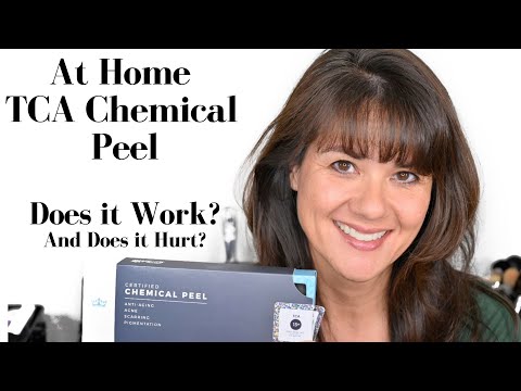 DIY TCA Chemical Peel - Does it Work? | YIKES!! IMPORTANT UPDATES IN DESCRIPTION