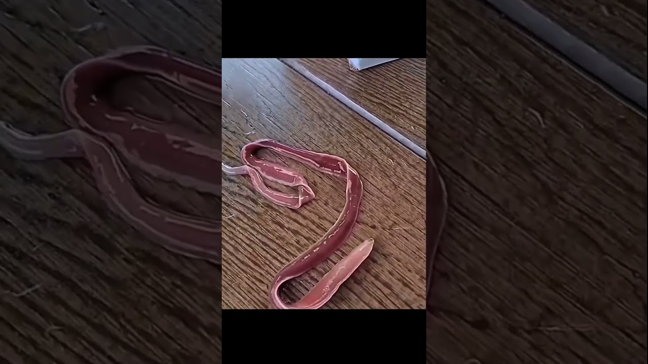 [ Attack on Titan 🔥🗿 ] #aot #shorts #animeedit #attackontitan #amv #edit #anime #amvanime