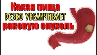 Какая пища резко увеличивает раковую опухоль Какая пища резко увеличивает раковую опухоль