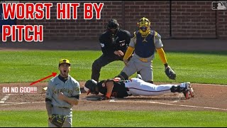 MLB 2024 | Worst hit by pitch
