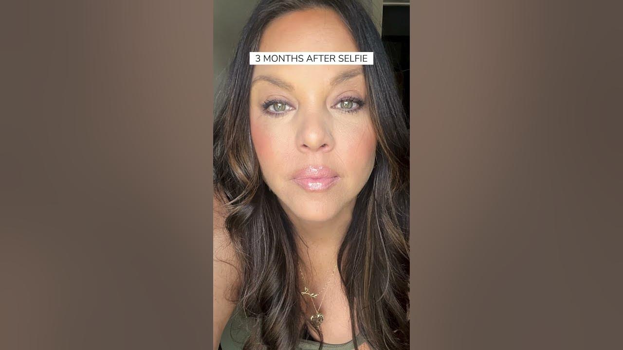 can-t-hide-eye-bags-with-makeup-this-may-help-you-trifecta-lift-dr