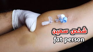 تركيب كانيولا لشخص سمين_cannula insertion for fat person