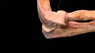 Acland's Video Atlas of Human Anatomy: Elbow