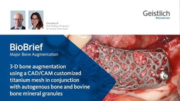 3D bone augmentation using CAD/CAM technology, biomaterials and autologous bone