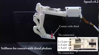 TMECH UnderactuatedFinger