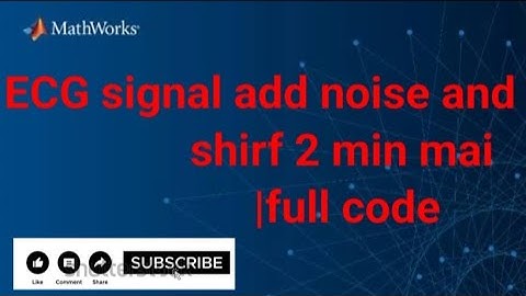 How to create the ECG signal using matlab