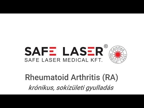 Videó: Rheumatoid Arthritis ájurvédikus Kezelése: Hogyan Működik?