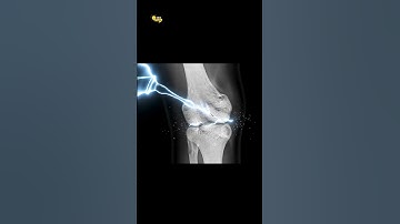 China’s Magic Bone Glue! 😳