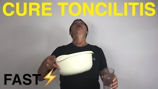 How to cure tonsillitis naturally!