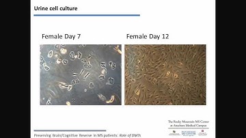 Preserving Brain/Cognitive Reserve in MS Patients: Role of Disease Modifying Therapies