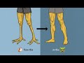 Fix your chicken legs with these 6 excercises