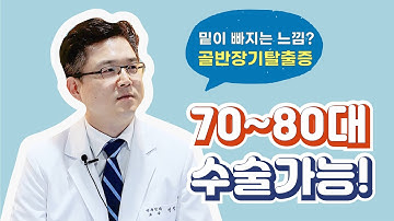 [Dr.log] 밑이 빠지는 느낌? 골반장기 탈출증, 70~80대 수술 가능!