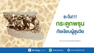 ระวัง กระดูกพรุน ภัยเงียบ ผู้สูงวัย