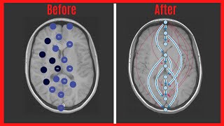 You Must Learn This Pattern | Topological Sort