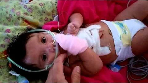 Little Sofia after heart surgery
